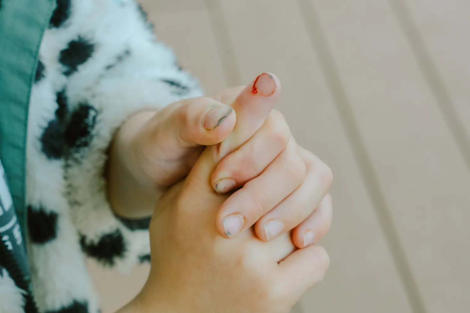 ケンカやちいさなケガの画像